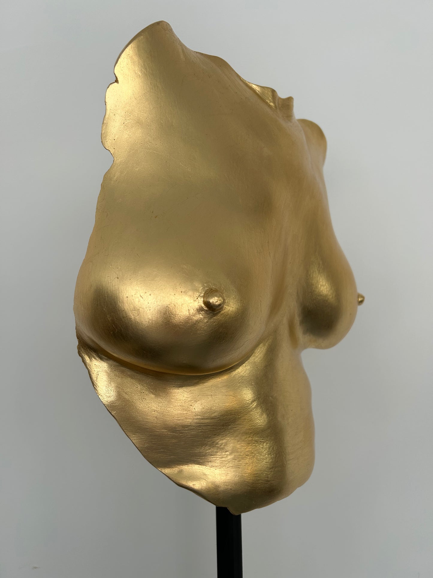 S.T. Breast Cast