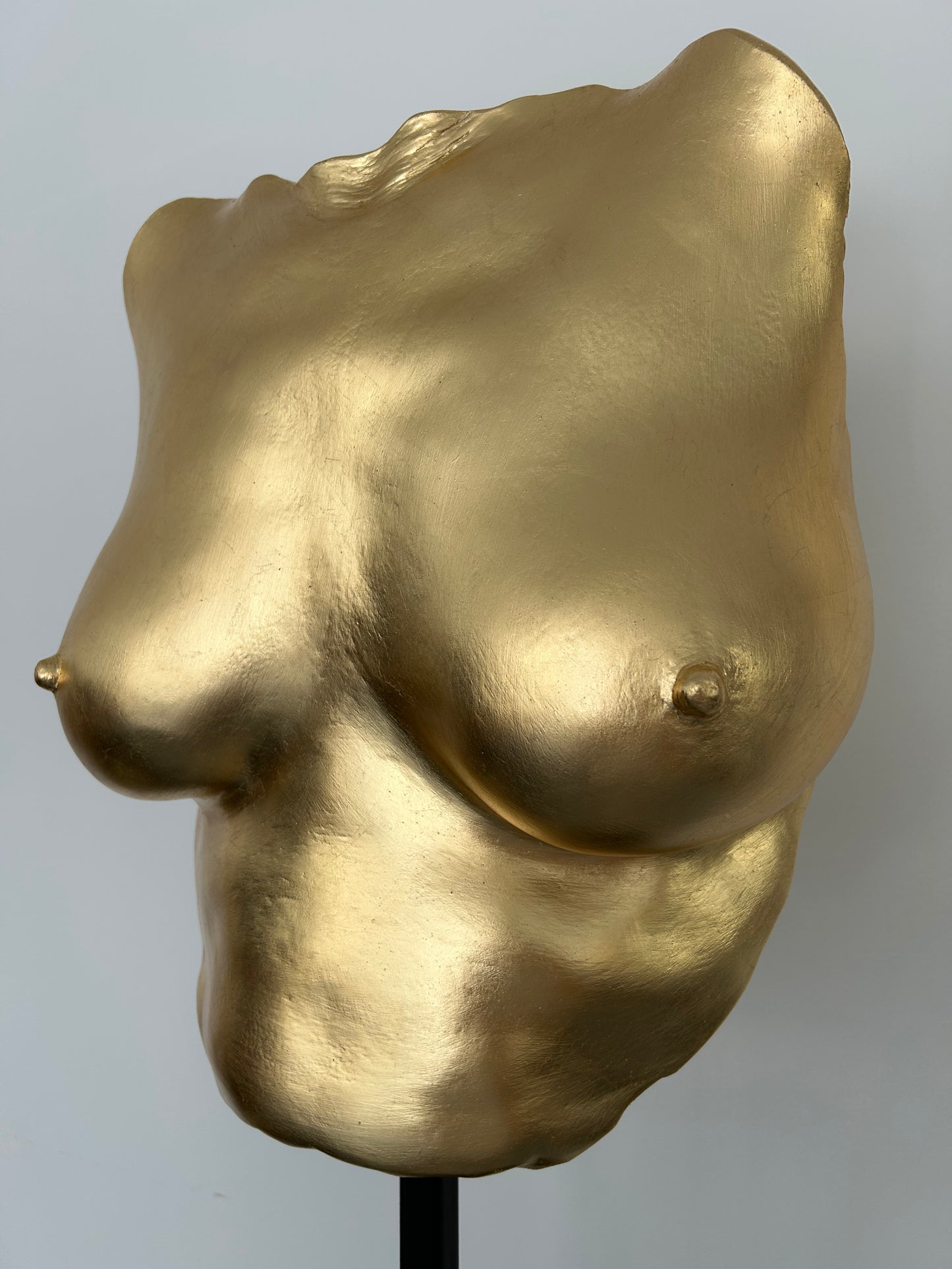 S.T. Breast Cast
