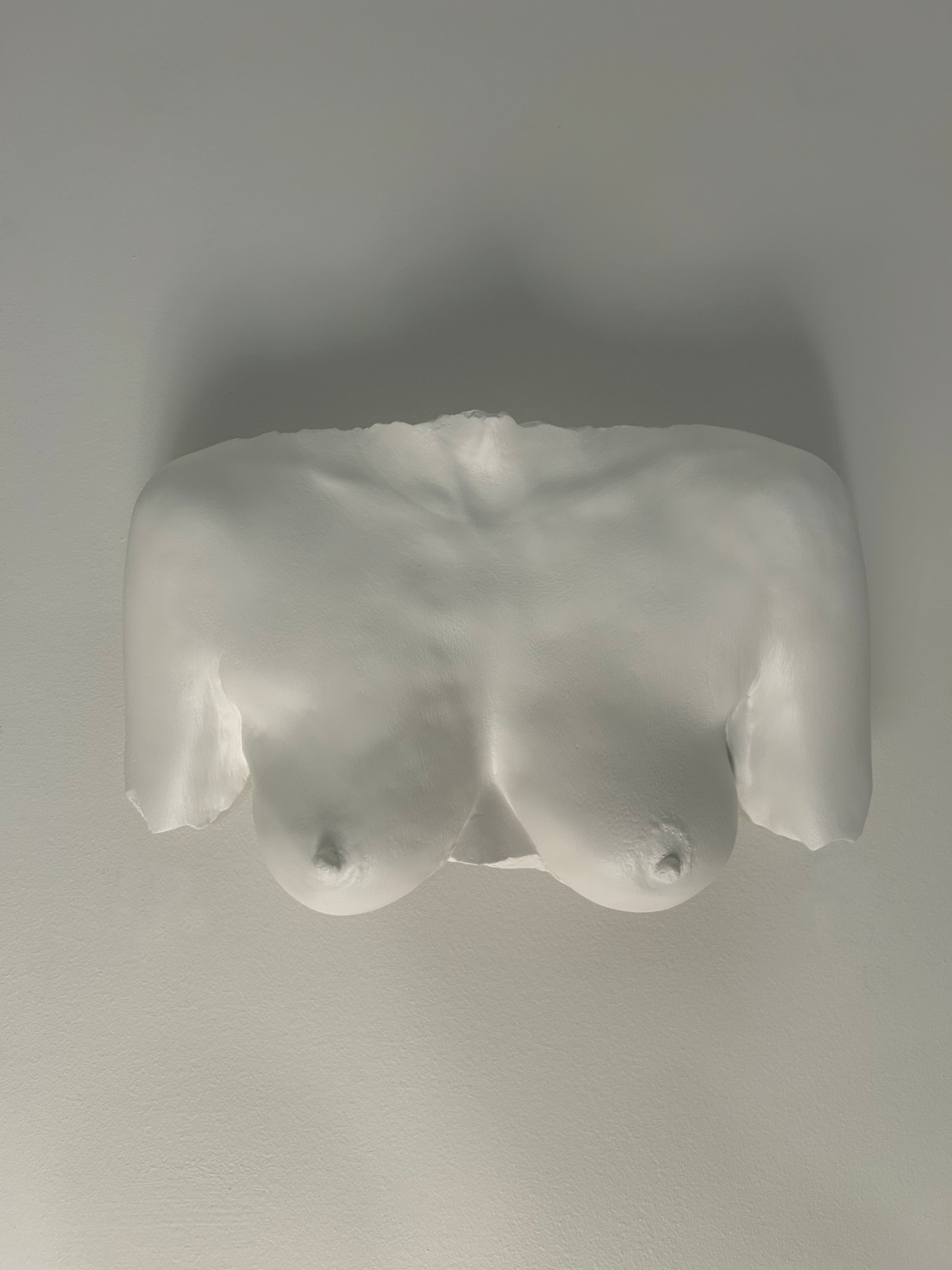 Wall Mount Breast Cast
