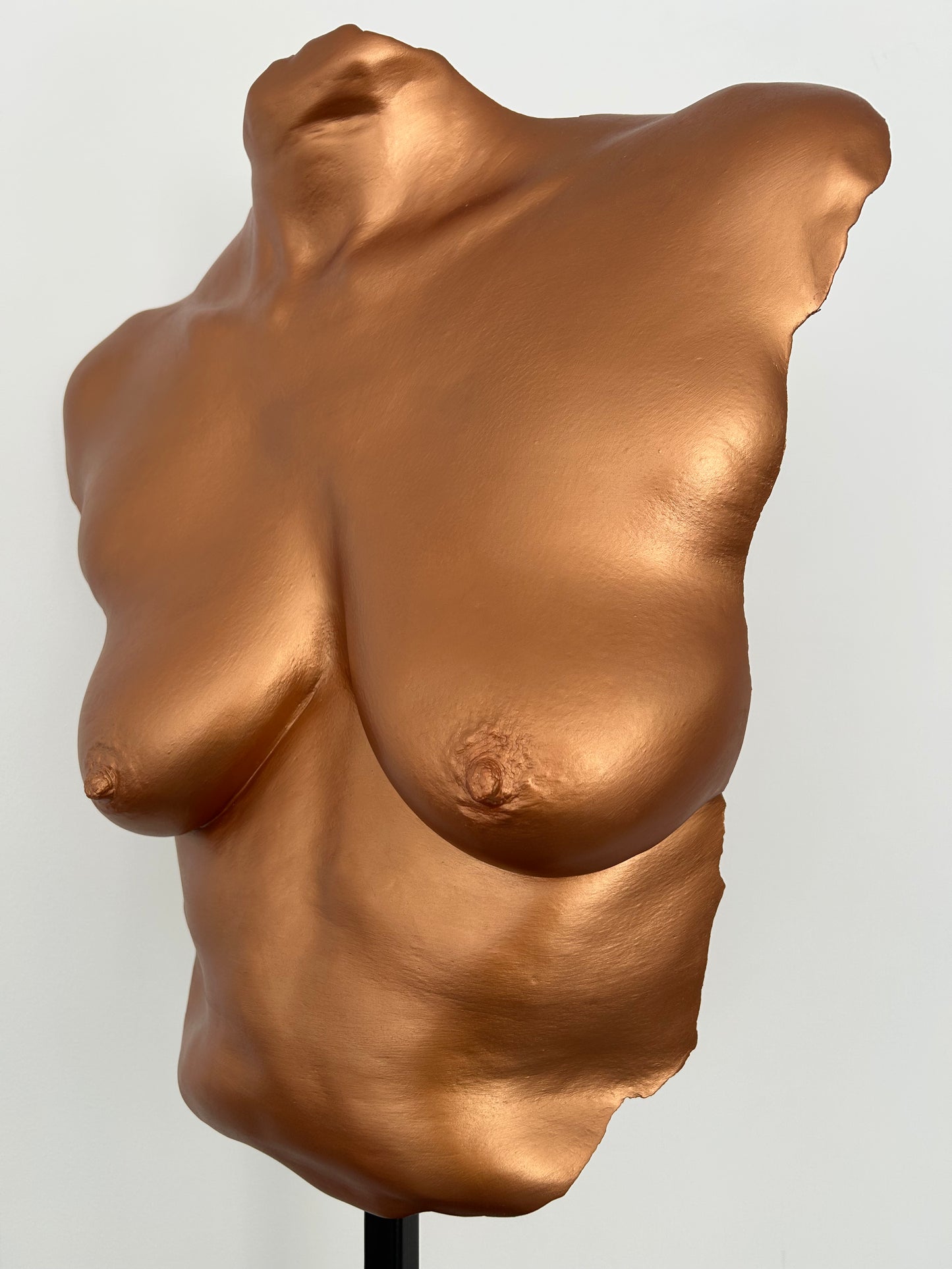 C.B. Breast Cast