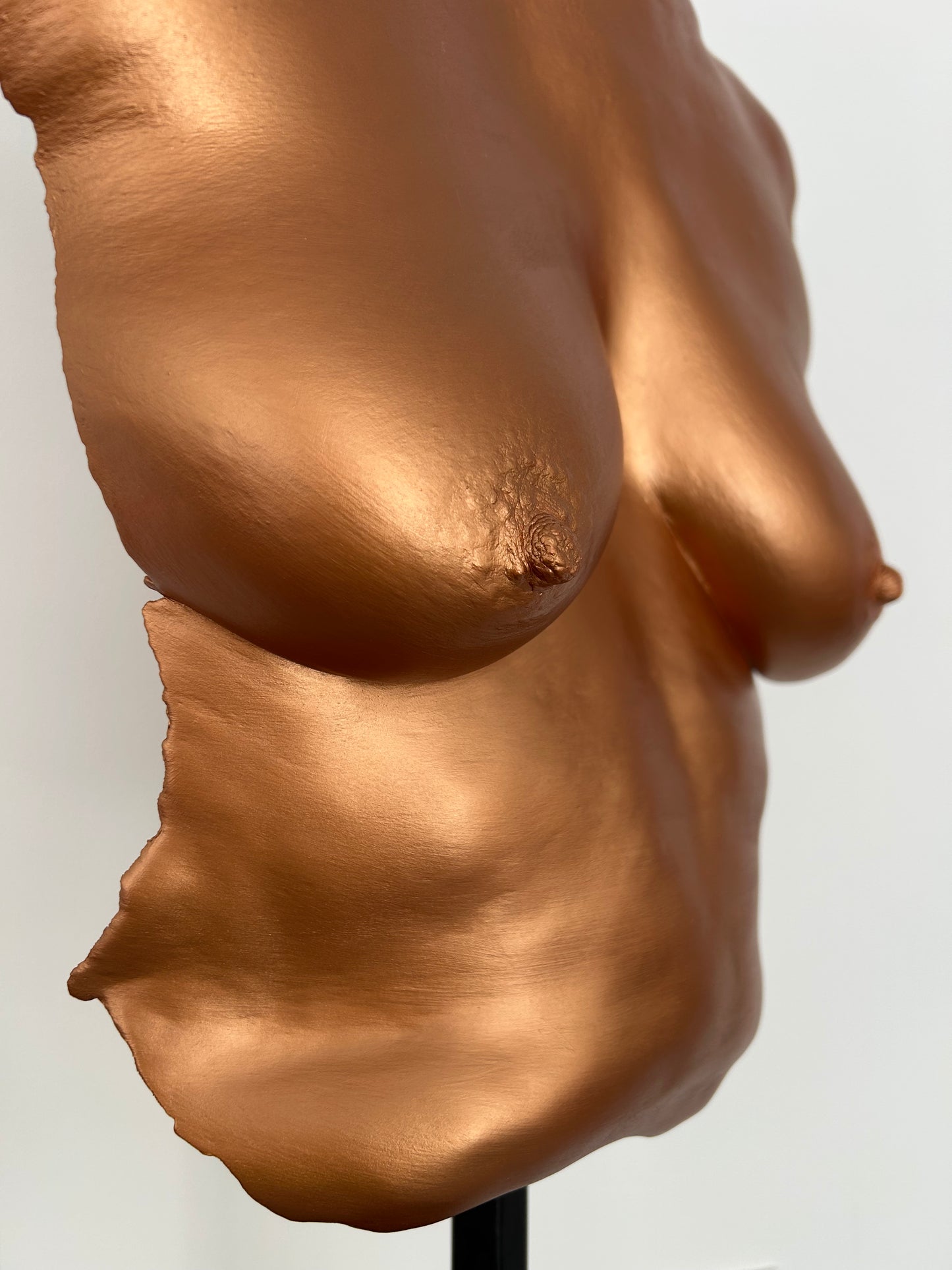 C.B. Breast Cast