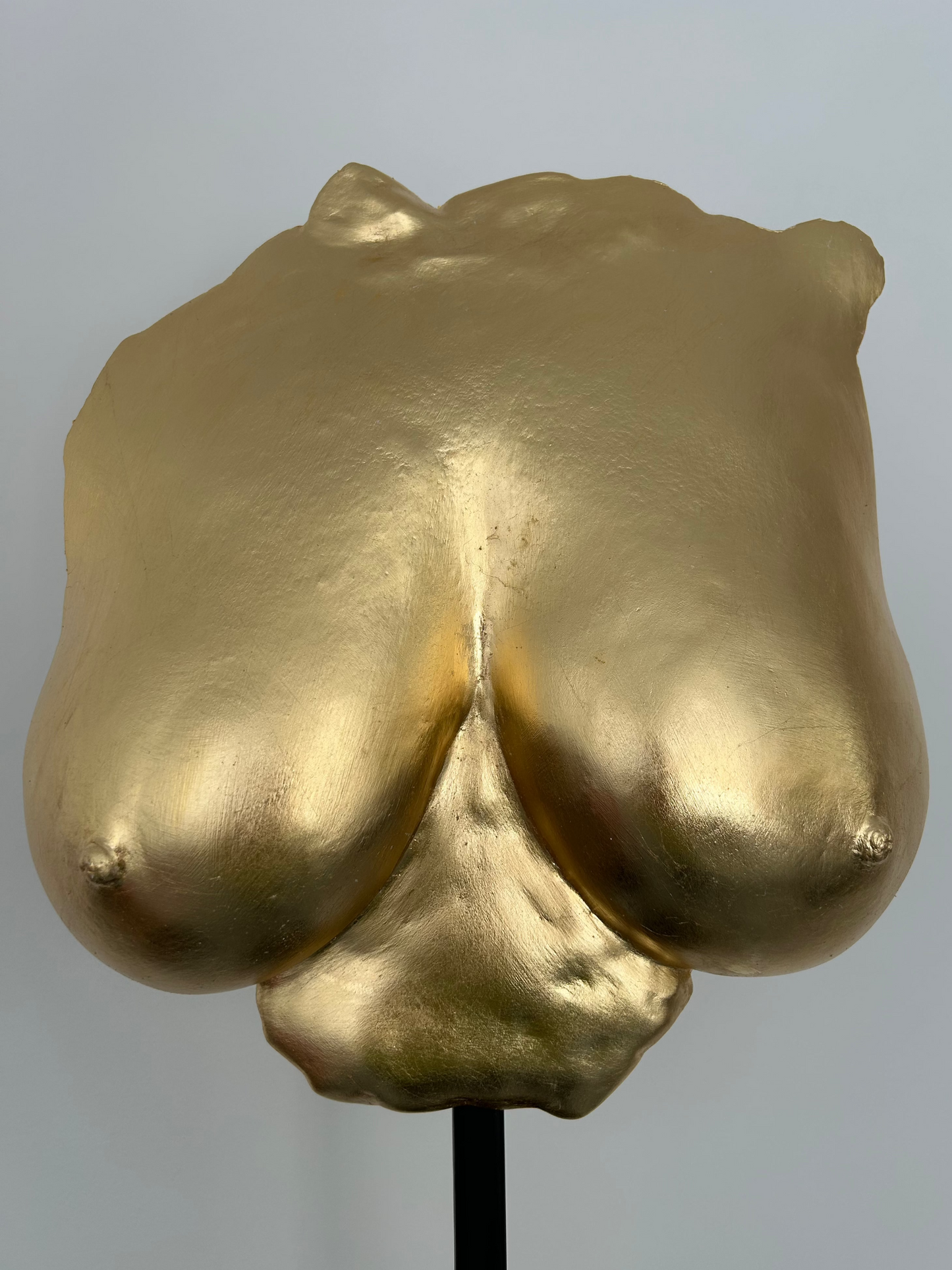 M.E. Breast Cast