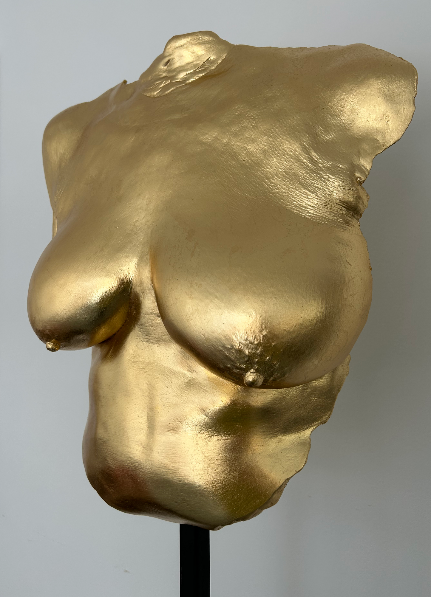 D.W. Breast Cast