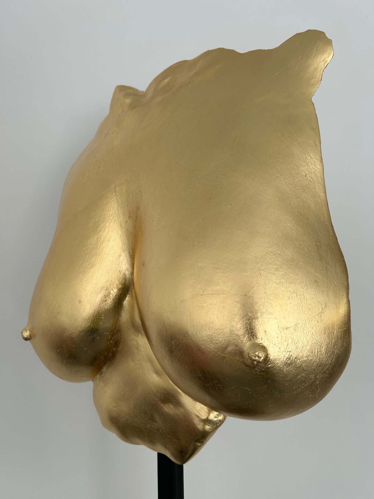 M.E. Breast Cast