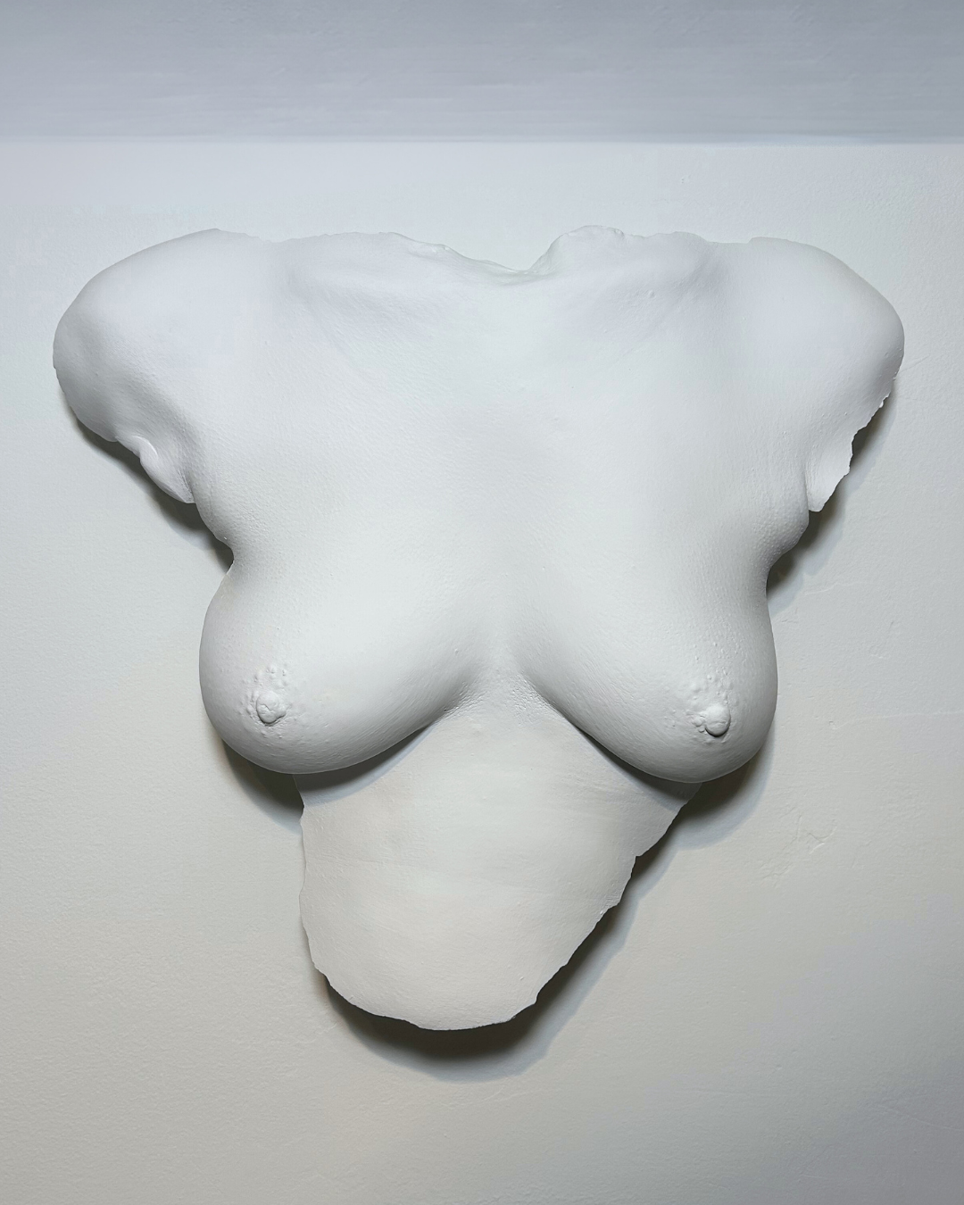 Custom Wall Mount Breast Cast