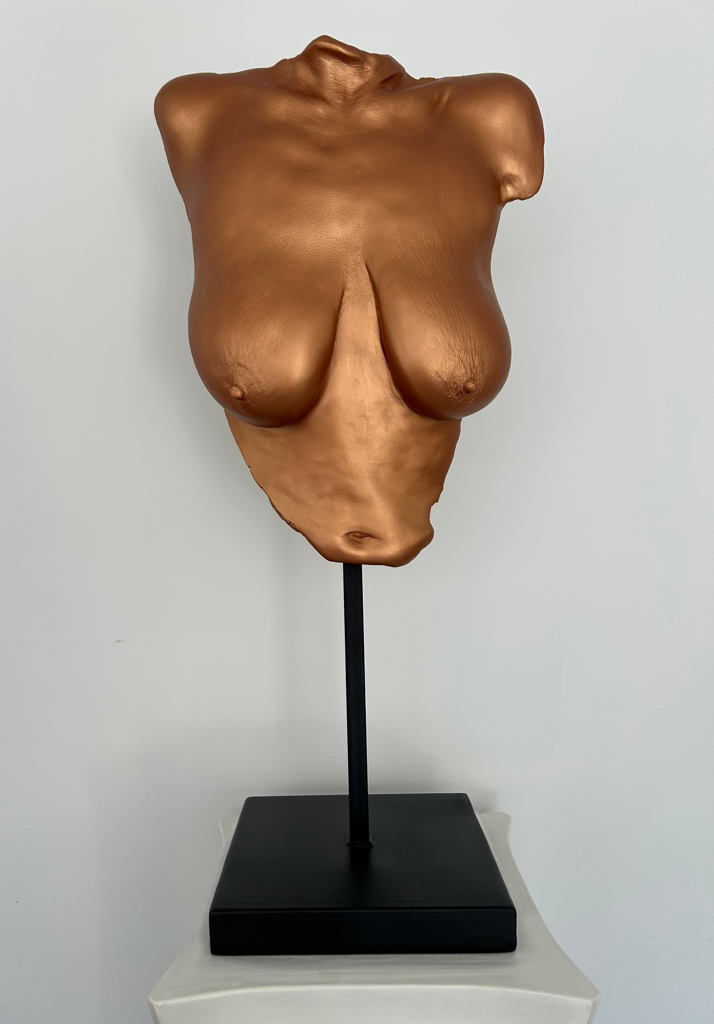 N.P. Breast Cast