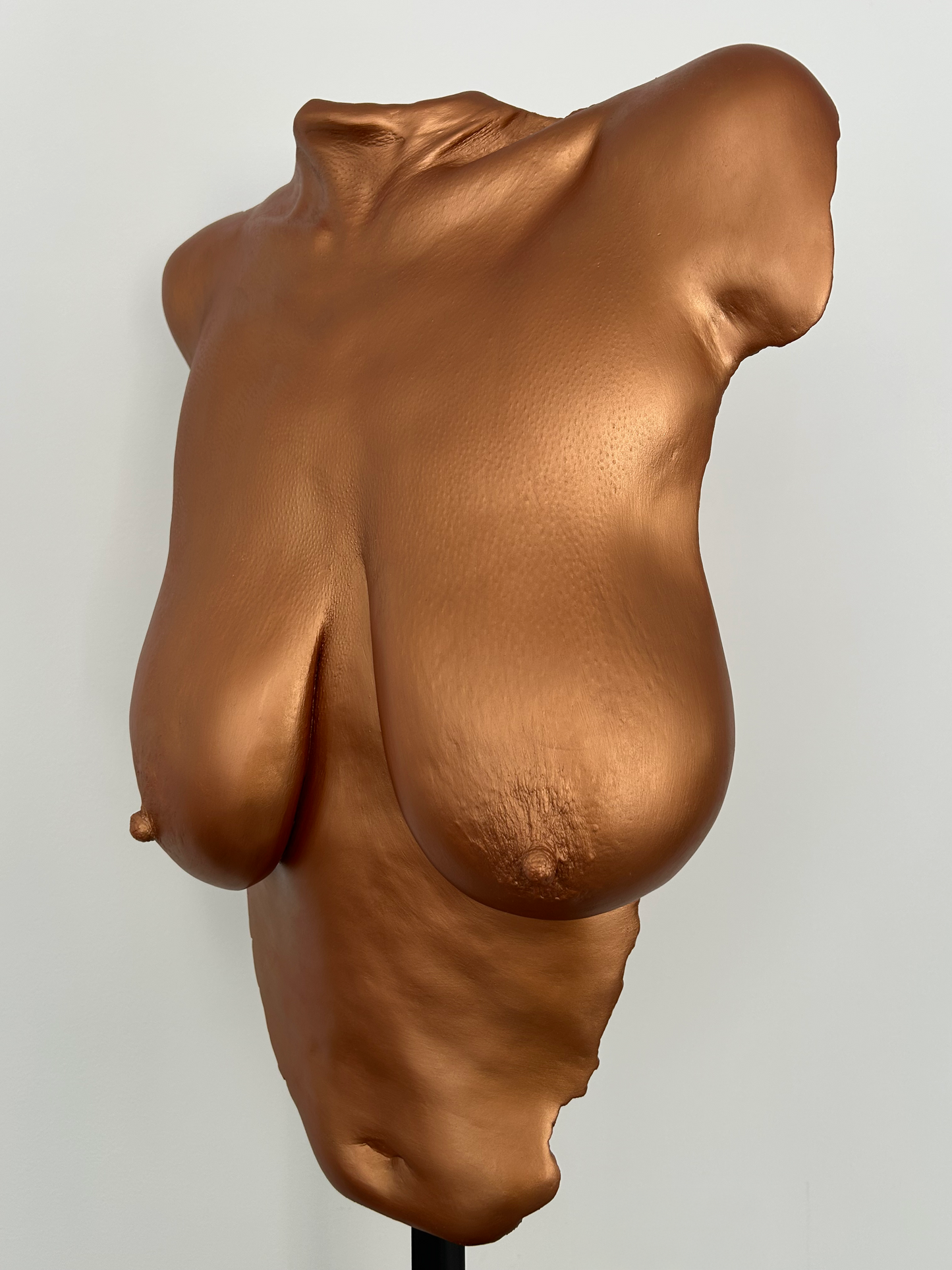 N.P. Breast Cast