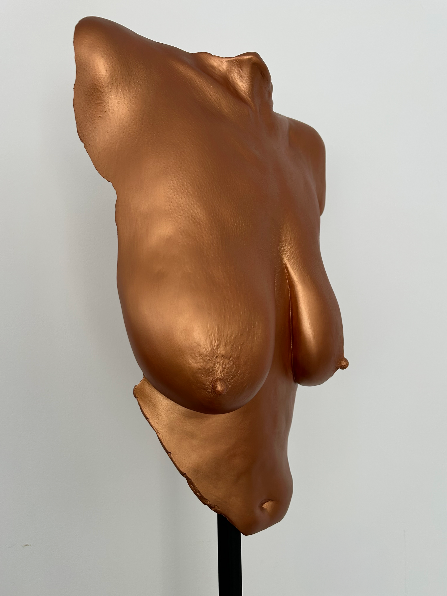 N.P. Breast Cast