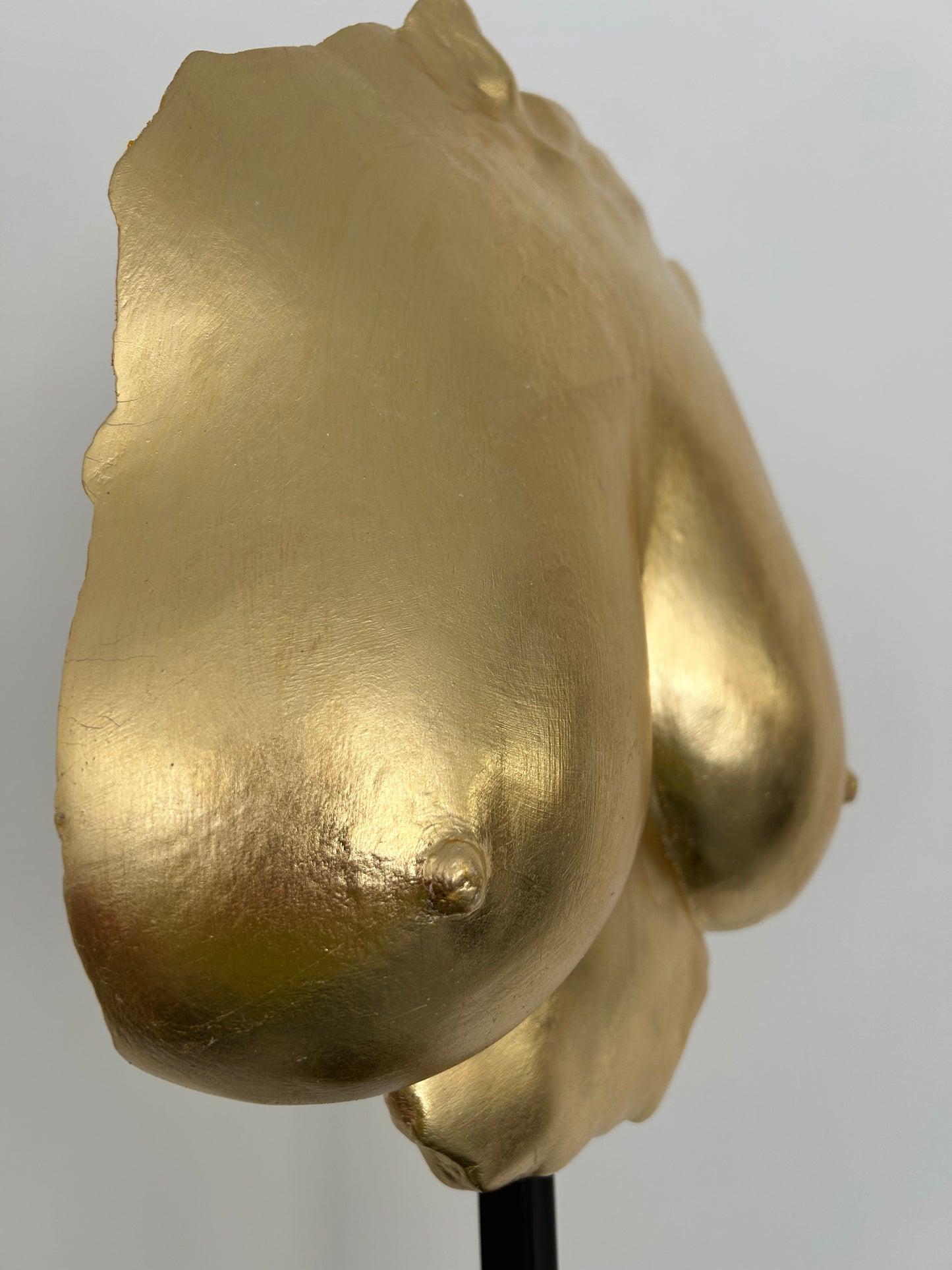 M.E. Breast Cast