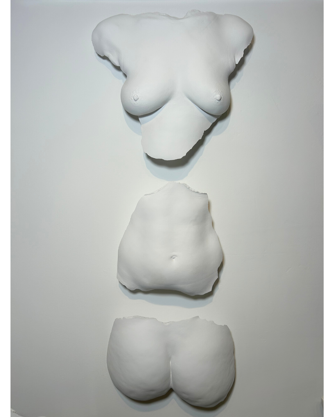Custom Wall Mount Breast Cast