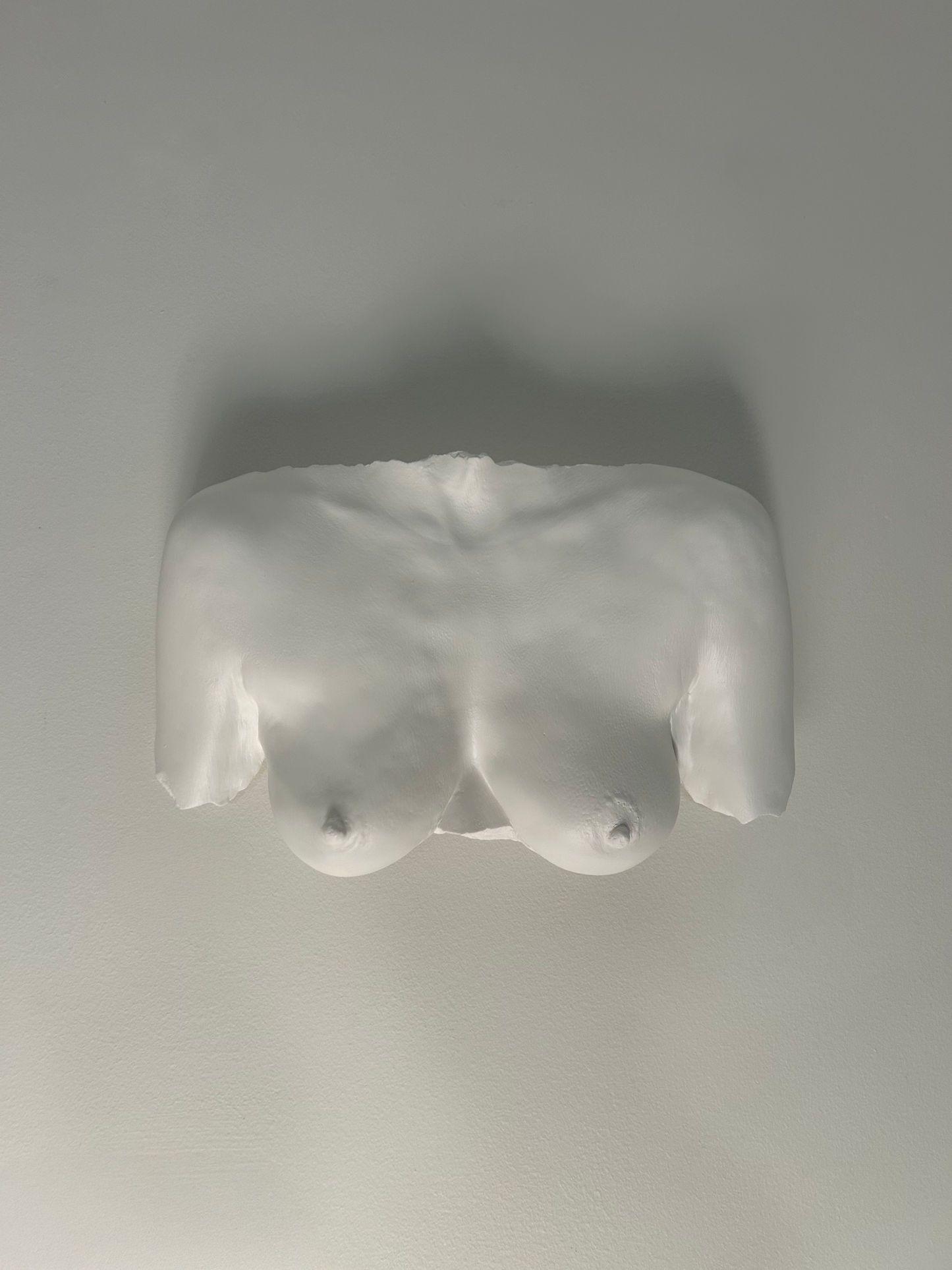 Wall Mount Breast Cast