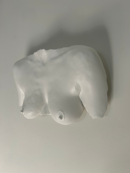 Wall Mount Breast Cast