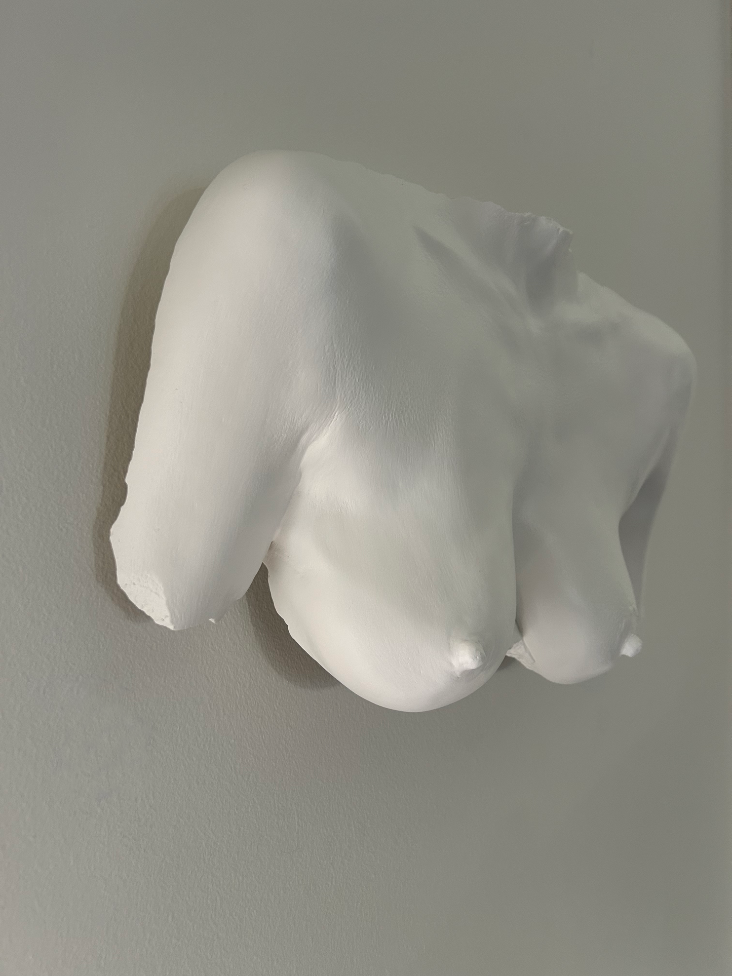 Wall Mount Breast Cast