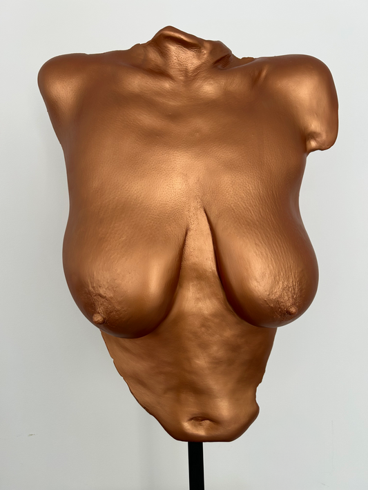 N.P. Breast Cast